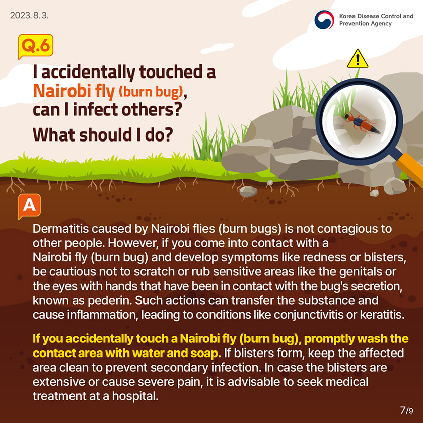 Q6. I accidentally touched a Nairobi fly (burn bug), can I infect others? What should I do? Dermatitis caused by Nairobi flies (burn bugs) is not contagious to other people. However, if you come into contact with a Nairobi fly (burn bug) and develop symptoms like redness or blisters, be cautious not to scratch or rub sensitive areas like the genitals or the eyes with hands that have been in contact with the bug's secretion, known as pederin. Such actions can transfer the substance and cause inflammation, leading to conditions like conjunctivitis or keratitis. If you accidentally touch a Nairobi fly (burn bug), promptly wash the contact area with water and soap. If blisters form, keep the affected area clean to prevent secondary infection. In case the blisters are extensive or cause severe pain, it is advisable to seek medical treatment at a hospital.